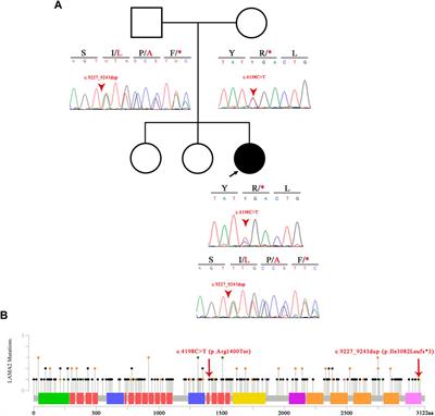 Case report: Novel frameshift mutation in LAMA2 gene causing congenital muscular dystrophy type 1A
